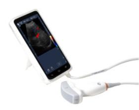 China High Resolution Portable Doppler Ultrasound Machine With 6 Inch Full Touch Screen wholesale