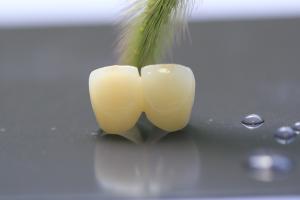 China 3D Print Framework PFM Dental Lab Crown For Dentistry wholesale
