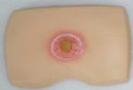 GD/H90D decubitus evolution and developping models shows cutaneous reaction
