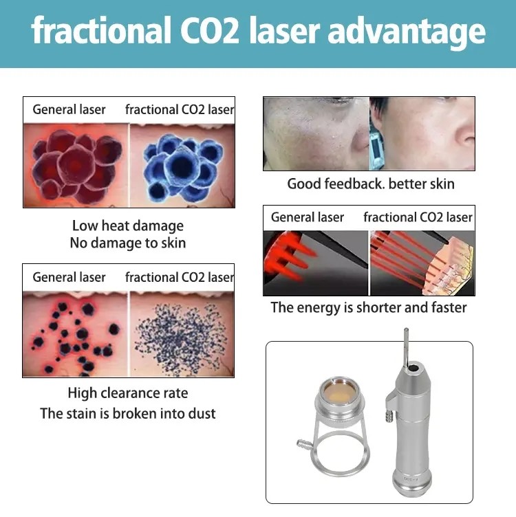 60W Fractional Treatment Co2 Laser Skin Rejuvenation Machine 10600nm
