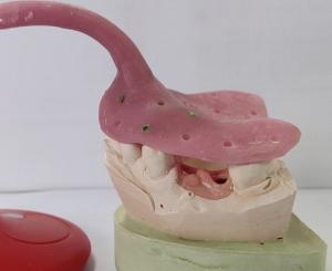 China Custom Denture Impression Trays wholesale