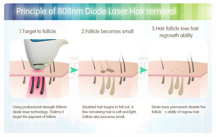 Rechargeable VCA IPL Hair Removal Machine 808nm Ellipse IPL Machine