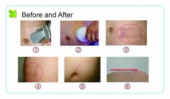 before and after treatment.jpg