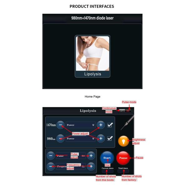 980nm 1470nm Diode Laser Gynecology Vaginal Tightening Surgery Laser