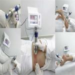 16HZ Electromagnetic Therapy Machine Erectile Dysfunction Reduce Expenses Eswt
