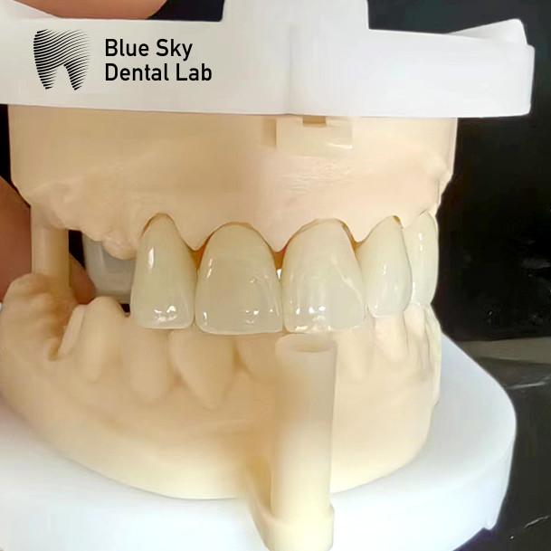 Layered Zirconia Crowns Pink Porcelain Zirconia Dental Crown For Aesthetic Restorations