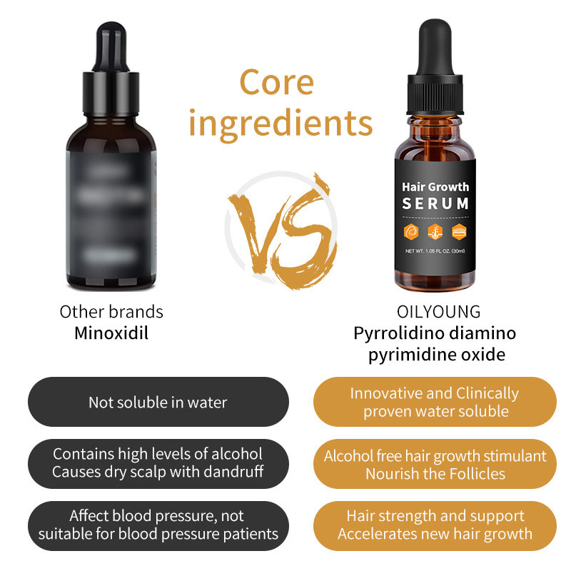 Customization Hair Growth Treatment Serum for Black Women Private Label