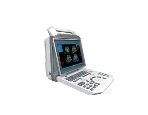 China SUCE-I50 12.1'' Digital Ultrasound machine wholesale
