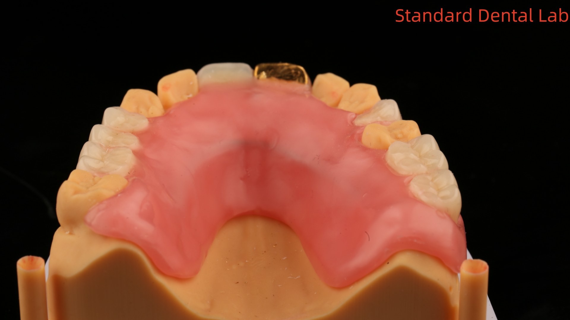 Full Acrylic Dentures With Yellow Gold Teeth/Dental Temporary Acrylic Denture Ivoclar Professional FDA Approved