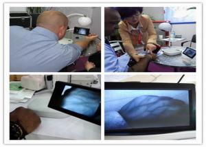 China 800*480 Resolution Clear Vein Imaging Vein Viewer Detector wholesale