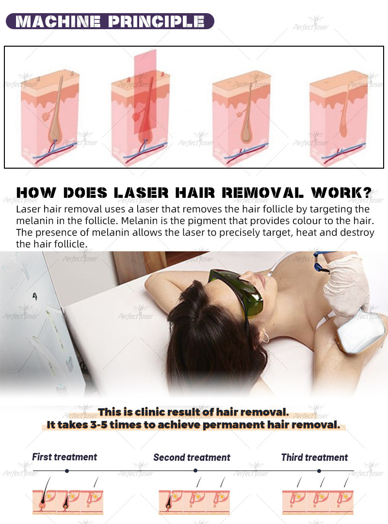 15.6 Inch Android Color Touch Screen Diode Laser Hair Removal Machine