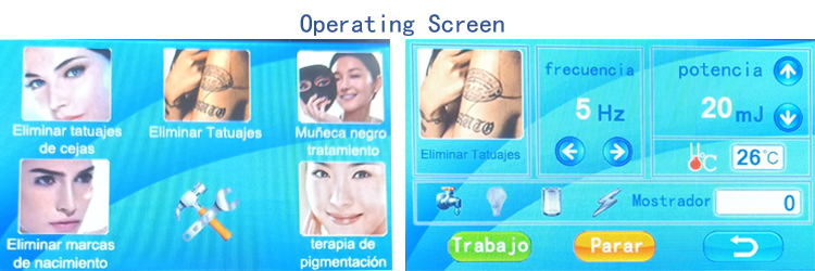 Nd Yag Laser Tatoo Removal Machine Pigmentary Skin EMC / CE Approved