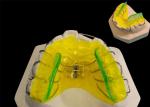 Custom Made Orthodontic Removable Appliances , Adjustable Expander Orthodontics