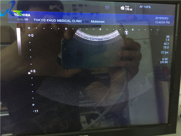Toshiba PVU-375BT Ultrasound Probe Repair Lens Replacement