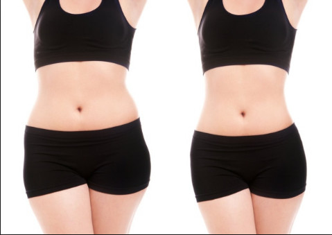 Cryolipolysis slimming equipment Cryolipolysis fat freezing slimming equipment