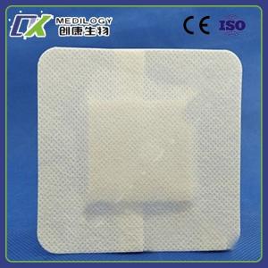 China Hot Selling Catheter Fixation Device Catheter for Medical Supplies wholesale