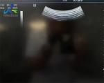 Probe Repair Mindray Ultrasound Probe 3C5S Lens Replacement
