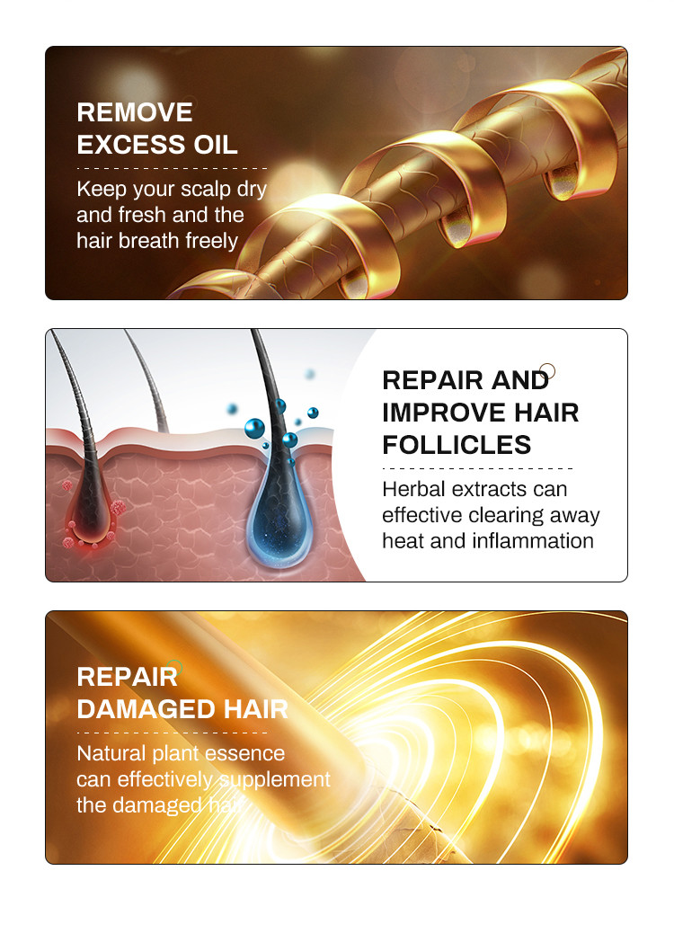 300 ML Private Label Oil Control Natural Plant Hair Growth Anti Hair Loss Shampoo