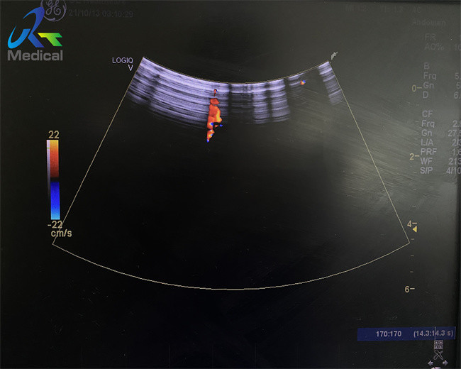 GE 12L-RS Ultrasound Probe Repair For Crystal Array Replacement