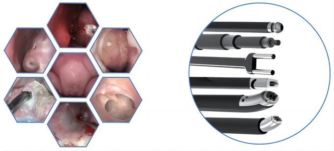 ENT RF Plasma Surgical System Cryogenic Surgical Device