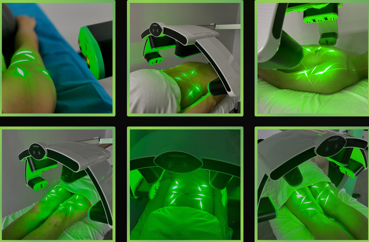 Emerald Laser Fat Reduction Machine With 5332nm 10pcs Diodo