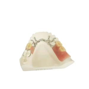 China Cocr Chrome Cast Removable Dental Crown Easy Clean Strong Hardness wholesale