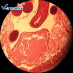 Hospital Research Special 76.2*25.4 Prepared Microscope Slides