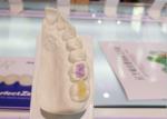 Custom High-Density Custom Dental Ceramics FDA All-Ceramic Crown