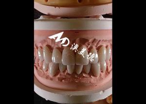 China Cosmetic Dentistry EMAX Dental Veneers 0.3-0.5mm Thick For Esthetic Restorations wholesale