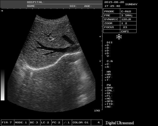 TGC Control Notebook Ultrasound Scanner For Pregnancy Home Use 8