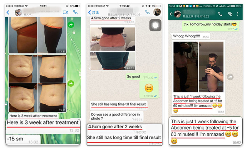 2018 newest  freeze fat body slimming 4 handles cryolipolysis 