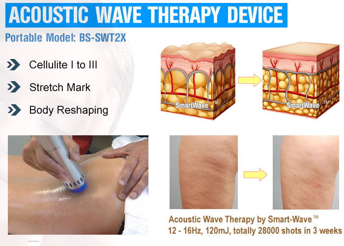 Skin Tightening Cellulite Treatment Machine 10 To 190mj Continuously Energy