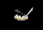 Porcelain Fused to Metal Crown with Enhanced Corrosion Resistance