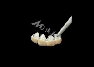 China Porcelain Fused to Metal Crown with Enhanced Corrosion Resistance wholesale