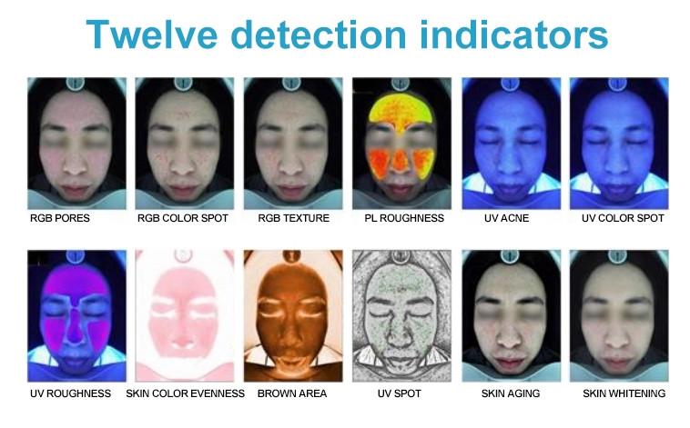 Professional Wrinkle Analysis Skin Scanner Using Digital Images Technologies