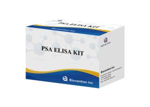 China High Accuracy Total PSA Prostate-Specific Antigen Elisa Test Kit wholesale