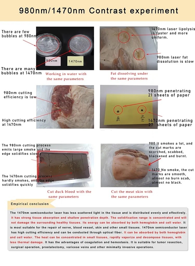 Medical Endolift Spider Vein Laser Machine / EVLT Laser Machine