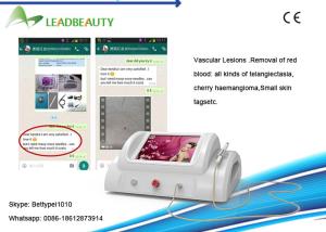 China 2016 hot sale rbs Vascular removal for face arms legs and the whole body wholesale