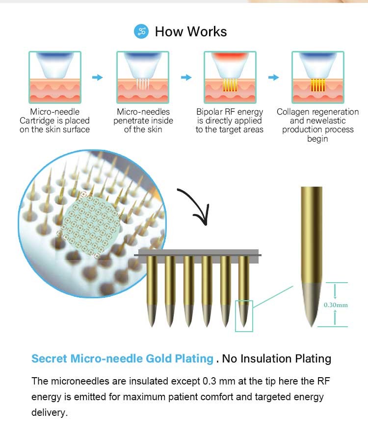 Skin Tightening RF Microneedling Machine 0.1-0.6s ISO13485 Certified