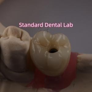 China Screw Retained Dental Implant Crown PFZ Porcelain Layered Zirconia wholesale