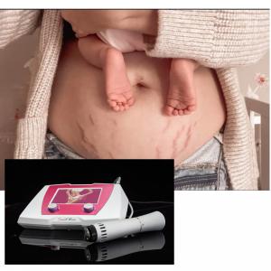 China Cellulite Treatment Acoustic Shockwave Therapy Device Shock Wave Cellulite Massage Machine wholesale