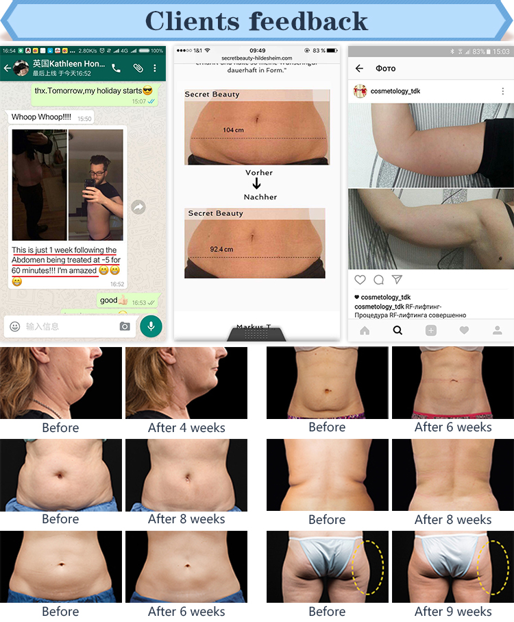 Beauty equipment powerful cavitation fast slimming / rf vacuum cavitation slimming machine