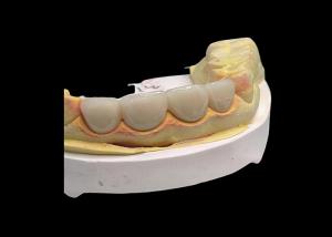 China Long lasting Wear resistant Strength all Ceramic Crown Bridge with Excellent Biocompatibility for dental restoration wholesale