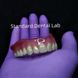 China Dental Removable Acrylic Denture Ivoclar Full Denture Acrylic Teeth wholesale