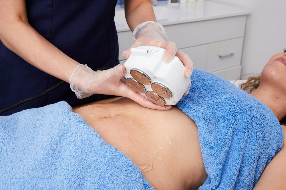 No Pain Ultrasonic Cavitation Machine To Remove Belly Fat Cell Remove 4D Cavitation Machine