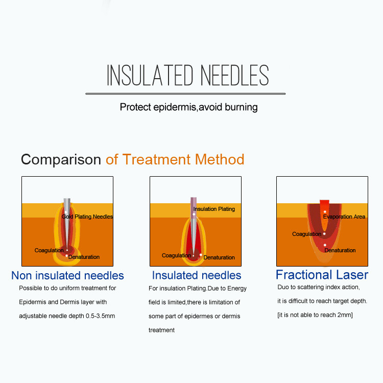 0.6s 1 Handle 3 Tips Scar Removal Rf Beauty Device