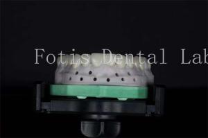 China High Strength Dental Lab Veneers Customizable For Natural Smiles wholesale