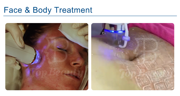 Skin Care Fractional Rf Microneedle Machine Body Radiofrequency Microneedle Beauty Equipment
