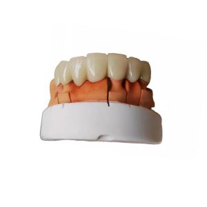 China Temporary PFM Dental Crown Smooth Surface High Quality Assurance wholesale