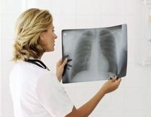 China 20cm X 25cm X Ray Diagnostic Imaging wholesale